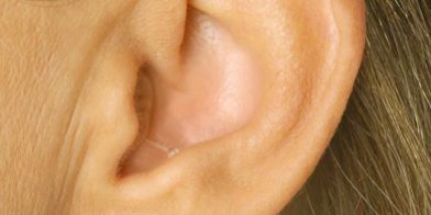 aparatos-auditivos-accesorios-05-gr